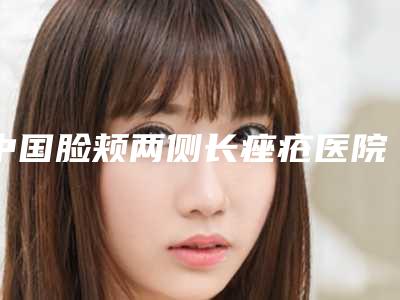 中国脸颊两侧长痤疮医院哪家好:脸颊两侧长痤疮医院前50名口碑篇揭晓