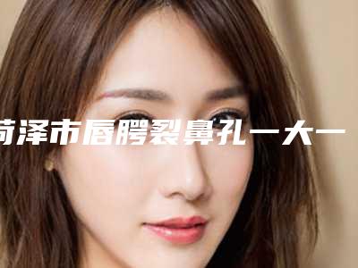 菏泽市唇腭裂鼻孔一大一小修复医生排行口碑曝光-旷冶医生整形价格查询