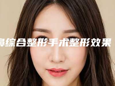 鼻综合整形手术整形效果如何
